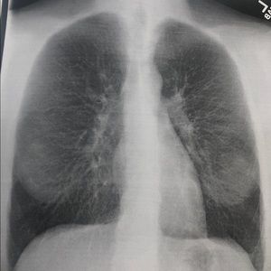 Meet your Posher, Tesia